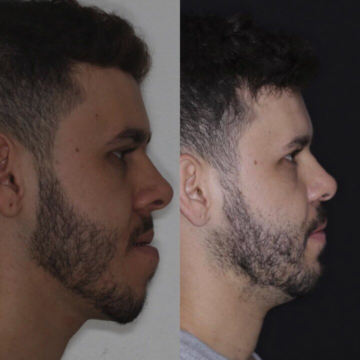 Instagram post from drrenatobaiao. This post is in position 0.