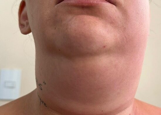 Instagram post from drrenatobaiao. This post is in position 9.