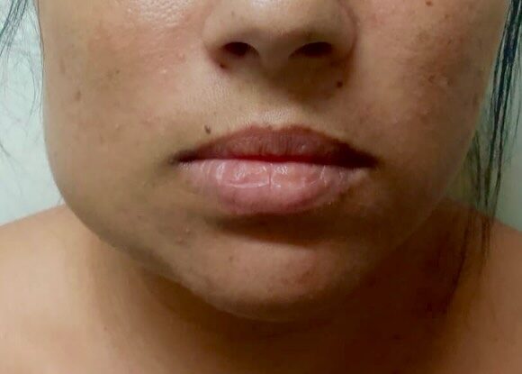 Instagram post from drrenatobaiao. This post is in position 4.