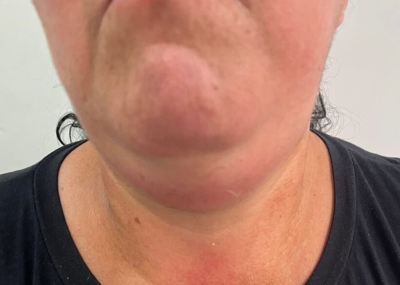 Instagram post from drrenatobaiao. This post is in position 8.