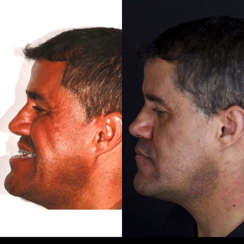 Instagram post from drrenatobaiao. This post is in position 1.