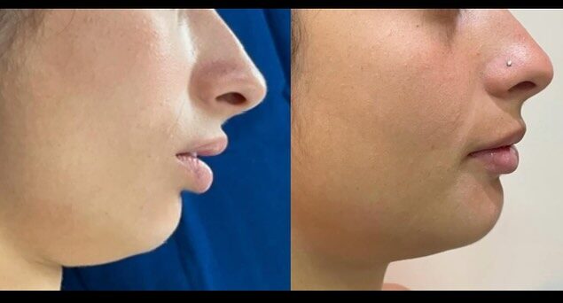 Instagram post from drrenatobaiao. This post is in position 0.