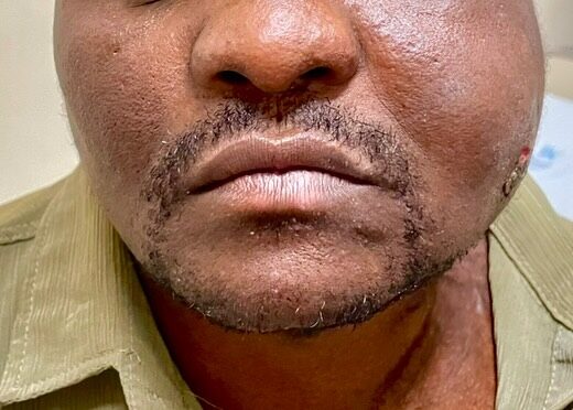 Instagram post from drrenatobaiao. This post is in position 2.