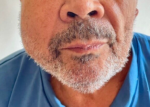 Instagram post from drrenatobaiao. This post is in position 1.