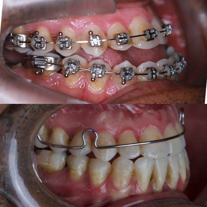 Instagram post from drrenatobaiao. This post is in position 2.