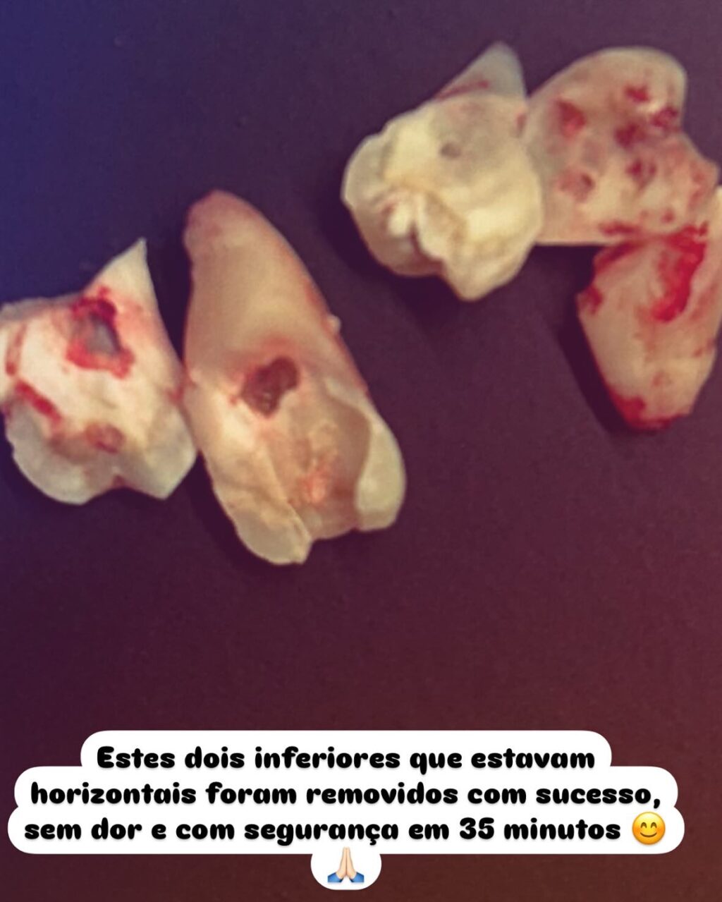 Instagram post from drrenatobaiao. This post is in position 1.