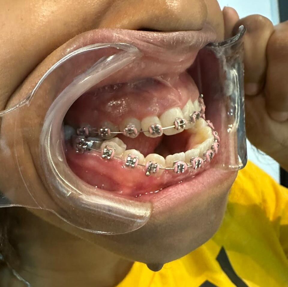 Instagram post from drrenatobaiao. This post is in position 1.