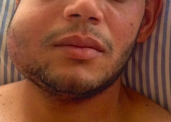 Instagram post from drrenatobaiao. This post is in position 3.