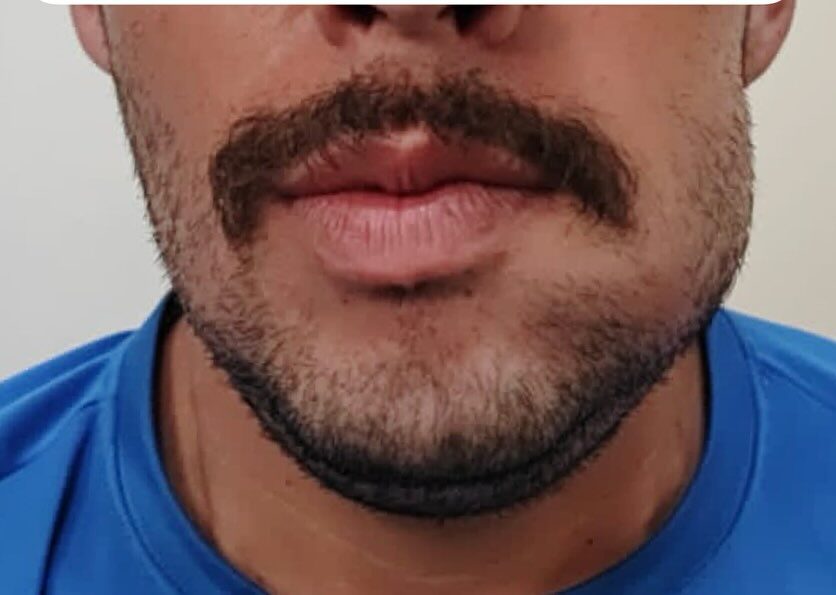 Instagram post from drrenatobaiao. This post is in position 5.