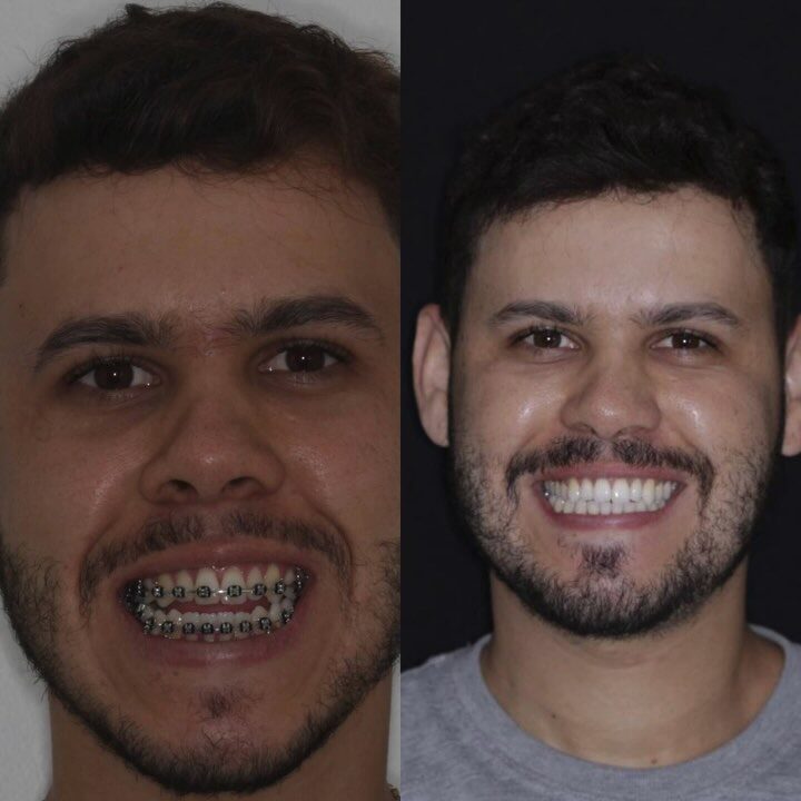 Instagram post from drrenatobaiao. This post is in position 1.