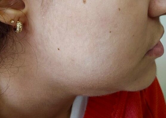 Instagram post from drrenatobaiao. This post is in position 6.