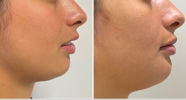 Instagram post from drrenatobaiao. This post is in position 1.