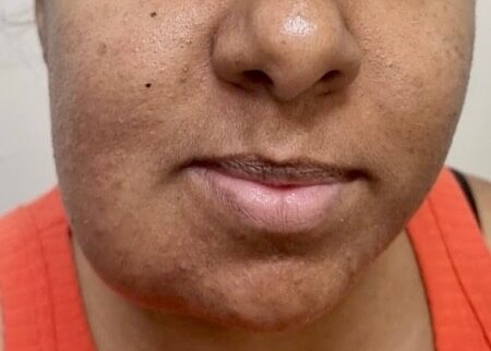 Instagram post from drrenatobaiao. This post is in position 5.