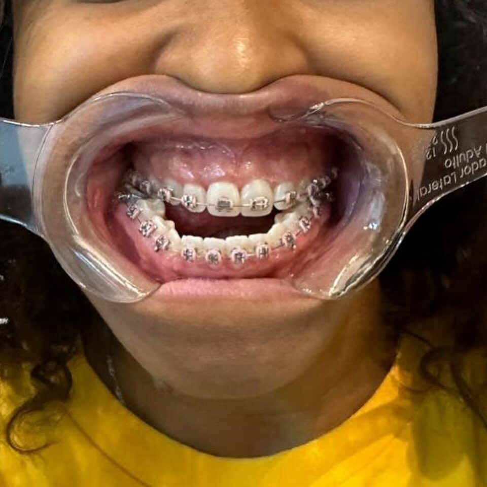 Instagram post from drrenatobaiao. This post is in position 8.