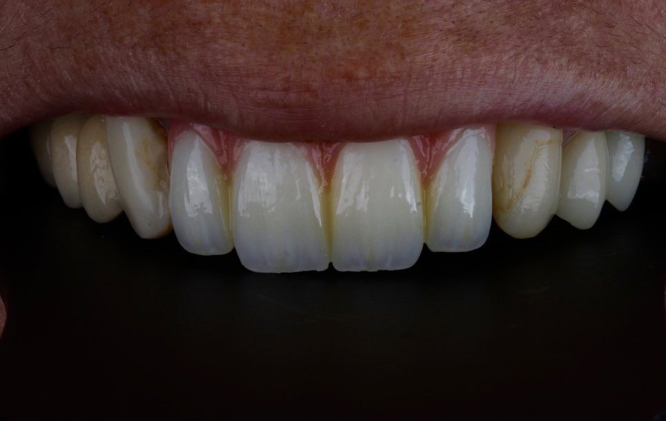 Instagram post from drrenatobaiao. This post is in position 2.