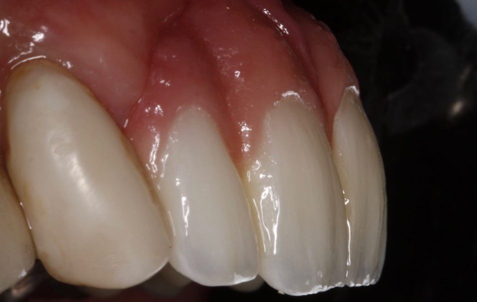 Instagram post from drrenatobaiao. This post is in position 3.